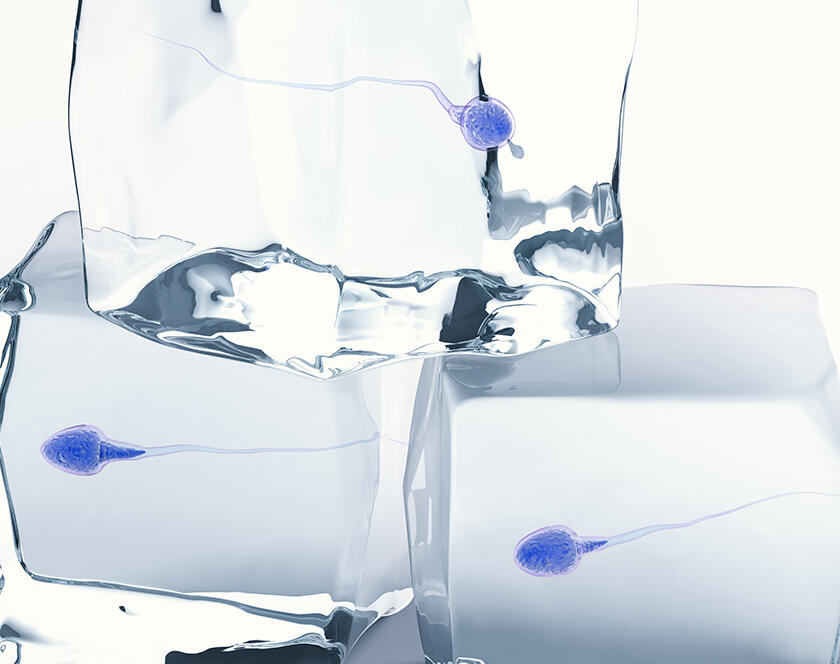 Sperm Freezing Treatment in Chennai